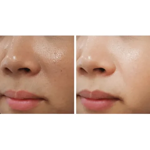Dibi White Advanced Cream for Pigmentation Removal - 40 ml