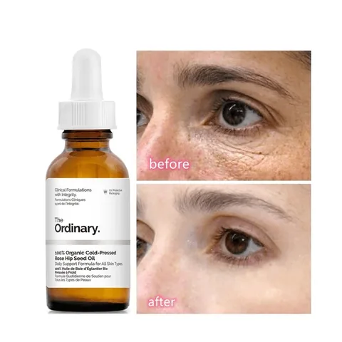 سيروم الكافيين 5% + إي جي سي جي من ذا أورديناري The Ordinary