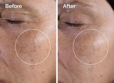 The Ordinary Glycolic Acid 7% Toning Solution Ph-3.6 240 ml