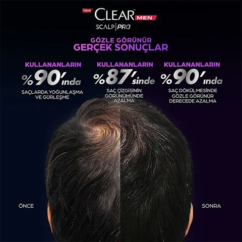 Clear شامبو كلير مين سكالب برو لتقوية فروة الرأس فعال ضد تساقط الشعر والقشرة 300 مل