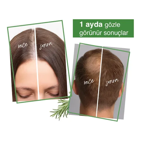 Yoon Anti Hair Loss Helps Fast Hair Growth 7 active Rosemary Hair Care Scalp Serum 50 ml