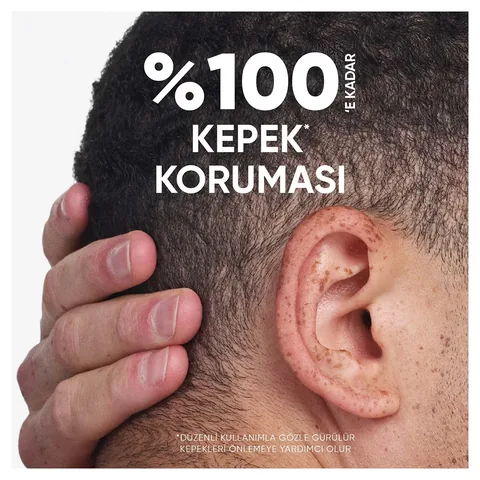 Head &amp; Shoulders Shampoo Lemon 2 in1 300 ml