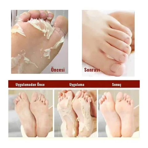 Mjcare Sock Type Foot Peeling Mask