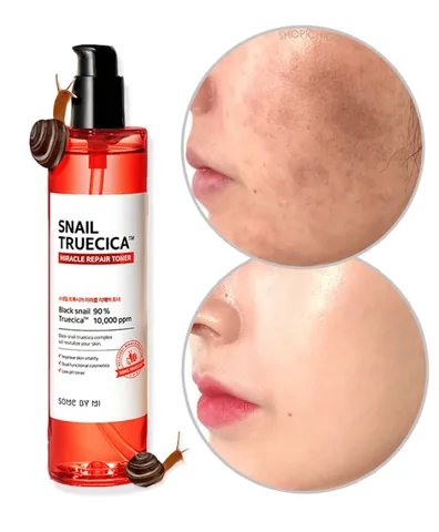 Snail Truecica Miracle Skin Repair Toner by Some By Mi - 135ml