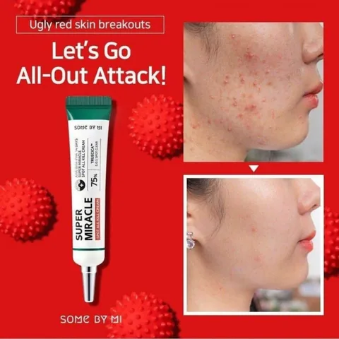 SooM Bye Me Miracle Spot Cream for Acne Treatment - 30ml