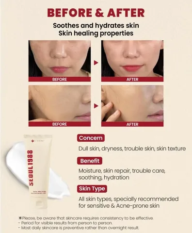 93% Snail and Rice Extract Cream 1988 - by K Secret 100ml