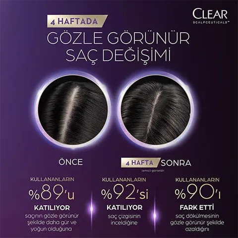 Clear Scalpceuticals Hair Care Shampoo Against Hair Loss 300 ml