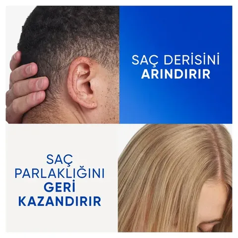 Head &amp; Shoulders Apple Cider Vinegar Anti-Dandruff Shampoo 330ml