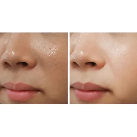 Dibi White Advanced Cream for Pigmentation Removal - 40 ml