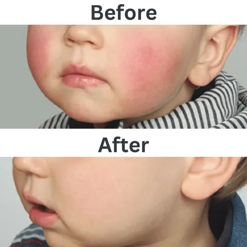Isdin Children's Skin Soothing and Moisturizing Cream 50ml